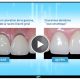 TV Dentiste