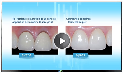 TV Dentiste