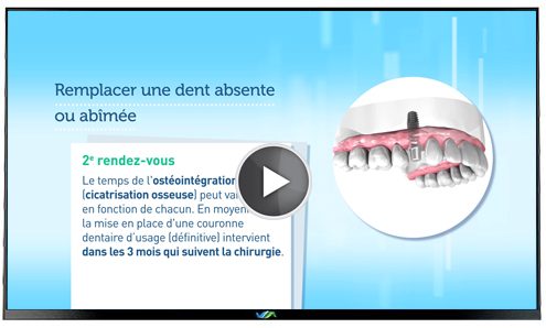 TV Dentiste